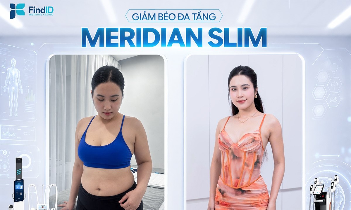 Find ID – Giải pháp lấy lại vóc dáng cân đối và nâng cao sức khỏe